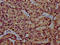 Component Of Oligomeric Golgi Complex 8 antibody, LS-C680310, Lifespan Biosciences, Immunohistochemistry paraffin image 
