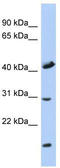 Cytochrome C Oxidase Assembly Factor COX18 antibody, TA331421, Origene, Western Blot image 