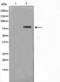 Spleen Associated Tyrosine Kinase antibody, TA325921, Origene, Western Blot image 