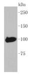 Maltose Binding Protein antibody, NBP2-67345, Novus Biologicals, Western Blot image 