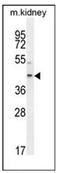 E2F2 antibody, AP51350PU-N, Origene, Western Blot image 