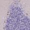 Phosphatidylinositol Glycan Anchor Biosynthesis Class M antibody, HPA047418, Atlas Antibodies, Immunohistochemistry paraffin image 