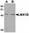 LIM homeobox transcription factor 1-beta antibody, TA319677, Origene, Western Blot image 