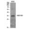 Hydroxysteroid 11-Beta Dehydrogenase 1 antibody, LS-C387647, Lifespan Biosciences, Western Blot image 