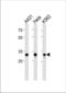 Amyloid Beta Precursor Protein Binding Family B Member 3 antibody, TA325130, Origene, Western Blot image 