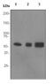 Transmembrane Serine Protease 2 antibody, ab92323, Abcam, Western Blot image 