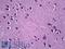 Neuronal acetylcholine receptor subunit alpha-6 antibody, LS-B6133, Lifespan Biosciences, Immunohistochemistry paraffin image 