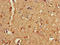 Purinergic Receptor P2X 1 antibody, orb50032, Biorbyt, Immunohistochemistry paraffin image 