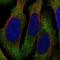 Integrin Subunit Beta 2 antibody, HPA016894, Atlas Antibodies, Immunocytochemistry image 