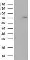 Myotubularin Related Protein 14 antibody, TA501738, Origene, Western Blot image 