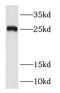 Ras-related protein Rab-38 antibody, FNab07021, FineTest, Western Blot image 