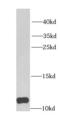 ACBP antibody, FNab02256, FineTest, Western Blot image 