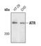 ATR Serine/Threonine Kinase antibody, PA5-17265, Invitrogen Antibodies, Western Blot image 