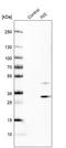 Insulin antibody, HPA004932, Atlas Antibodies, Western Blot image 