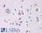 Delta Like Canonical Notch Ligand 1 antibody, LS-B72, Lifespan Biosciences, Immunohistochemistry paraffin image 