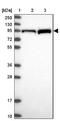 Protein kinase C epsilon type antibody, NBP2-38531, Novus Biologicals, Western Blot image 