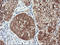 RAB30, Member RAS Oncogene Family antibody, LS-C337865, Lifespan Biosciences, Immunohistochemistry paraffin image 
