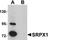 Sushi Repeat Containing Protein X-Linked antibody, AHP2236, Bio-Rad (formerly AbD Serotec) , Western Blot image 