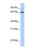 DGCR8 Microprocessor Complex Subunit antibody, ARP40984_P050, Aviva Systems Biology, Western Blot image 