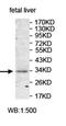 Ankyrin Repeat Domain 33 antibody, orb78075, Biorbyt, Western Blot image 