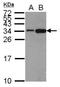 Histone Cluster 1 H1 Family Member C antibody, NBP2-16845, Novus Biologicals, Western Blot image 