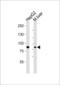 Prospero homeobox protein 1 antibody, LS-C162172, Lifespan Biosciences, Western Blot image 
