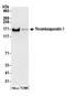 Thrombospondin 1 antibody, A304-989A, Bethyl Labs, Western Blot image 