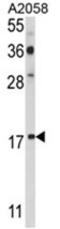 P53 And DNA Damage Regulated 1 antibody, AP17630PU-N, Origene, Western Blot image 