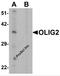 Oligodendrocyte Transcription Factor 2 antibody, 7743, ProSci, Western Blot image 
