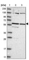 Coiled-Coil Domain Containing 181 antibody, PA5-55579, Invitrogen Antibodies, Western Blot image 