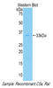 Complement C5 antibody, LS-C293485, Lifespan Biosciences, Western Blot image 