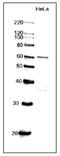 Cell Division Cycle 6 antibody, GTX00896, GeneTex, Western Blot image 
