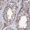Enhancer Of MRNA Decapping 3 antibody, HPA040650, Atlas Antibodies, Immunohistochemistry frozen image 