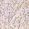 Small Nuclear Ribonucleoprotein Polypeptide A antibody, LS-C334695, Lifespan Biosciences, Immunohistochemistry frozen image 