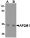 AP-2 complex subunit mu antibody, TA306777, Origene, Western Blot image 