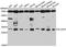 Solute Carrier Family 25 Member 1 antibody, A10247, ABclonal Technology, Western Blot image 