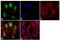 Hematopoietically-expressed homeobox protein HHEX antibody, 720258, Invitrogen Antibodies, Immunofluorescence image 
