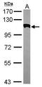 Actinin Alpha 2 antibody, GTX111167, GeneTex, Western Blot image 