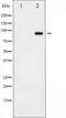 ADAM 17 antibody, TA325206, Origene, Western Blot image 