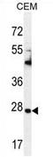 TIMP Metallopeptidase Inhibitor 1 antibody, AP54256PU-N, Origene, Western Blot image 