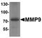 Matrix metalloproteinase-9 antibody, TA326652, Origene, Western Blot image 