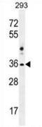 NK1 Homeobox 2 antibody, AP52890PU-N, Origene, Western Blot image 