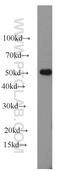 Smoothelin Like 1 antibody, 19560-1-AP, Proteintech Group, Western Blot image 