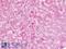 FAS antibody, LS-B9024, Lifespan Biosciences, Immunohistochemistry paraffin image 