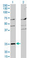 High affinity immunoglobulin epsilon receptor subunit beta antibody, LS-C197201, Lifespan Biosciences, Western Blot image 