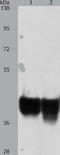 AUP1 Lipid Droplet Regulating VLDL Assembly Factor antibody, TA321997, Origene, Western Blot image 
