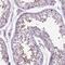 Barrier To Autointegration Factor 2 antibody, PA5-60062, Invitrogen Antibodies, Immunohistochemistry frozen image 