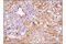 Epidermal Growth Factor Receptor Pathway Substrate 8 antibody, 43114S, Cell Signaling Technology, Immunohistochemistry paraffin image 