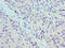 Ubiquitin-conjugating enzyme E2 J2 antibody, LS-C378629, Lifespan Biosciences, Immunohistochemistry paraffin image 