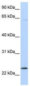ChaC Glutathione Specific Gamma-Glutamylcyclotransferase 1 antibody, TA329470, Origene, Western Blot image 